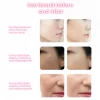 Powerful Skin Revolutionary Beauty Mask | LED Light Therapy | Face and Neck - Image 18
