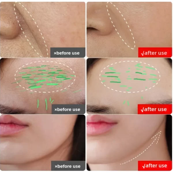 A before-and-after comparison of skin texture, wrinkles, and lip contour, demonstrating the effects of using the KAKUSAN skincare device.